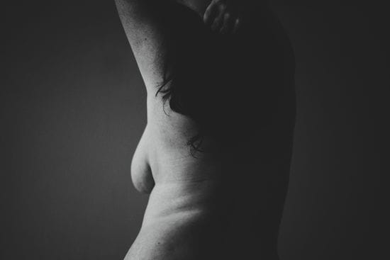 What Will My Scars Look Like After A Breast Reduction?